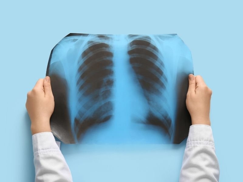 Who is Best Pulmonologist in Faridabad