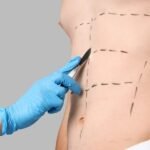 Who is the Best Plastic Surgeon in Faridabad