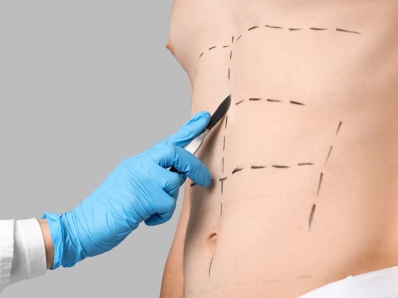 Who is the Best Plastic Surgeon in Faridabad